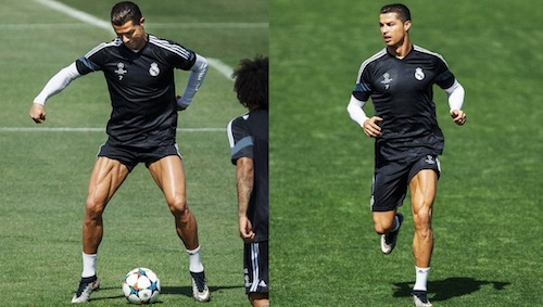 Cristiano Ronaldo Crazy Leg Veins