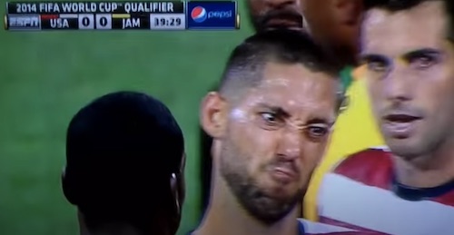 Dempsey Face
