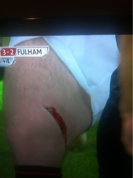 Wayne Rooney's Cut