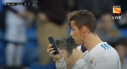 Bleeding Cristiano Ronaldo